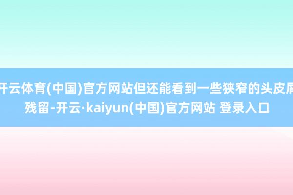 开云体育(中国)官方网站但还能看到一些狭窄的头皮屑残留-开云·kaiyun(中国)官方网站 登录入口